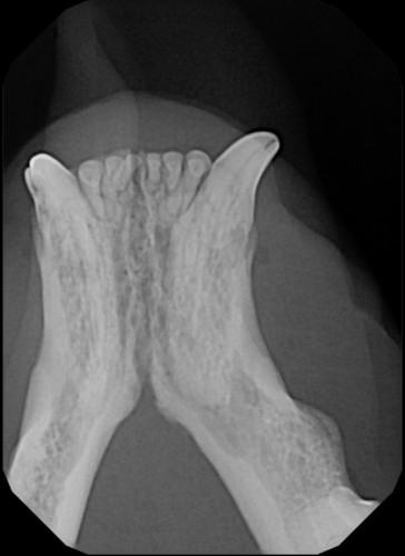 Tooth Resorption 3- mandibular canines